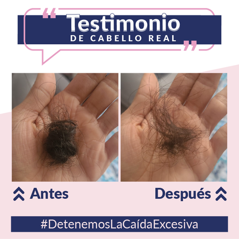 Antes y después de la caída del cabello