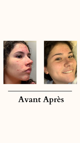 Before After: treatment The Cosmetist