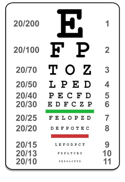 What if you have 20/20 vision in one eye and 20/25 vision in the