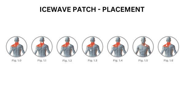 where to put the icewave patch