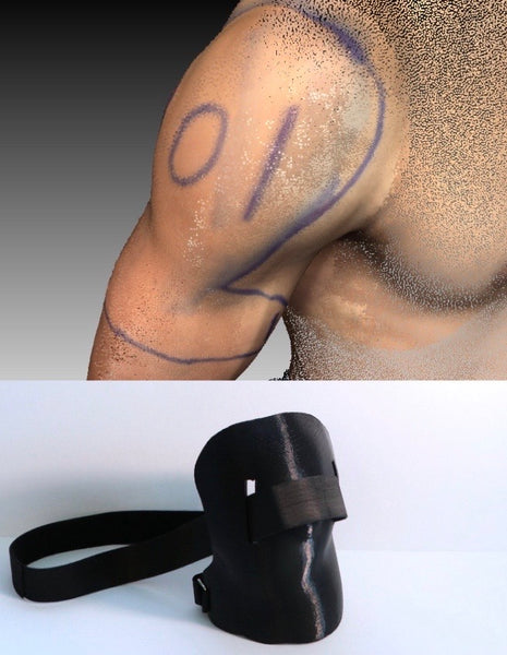 XO shoulder cast and 3D scan