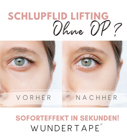 schlupflid stripes wundertape augenlid straffung ohne op