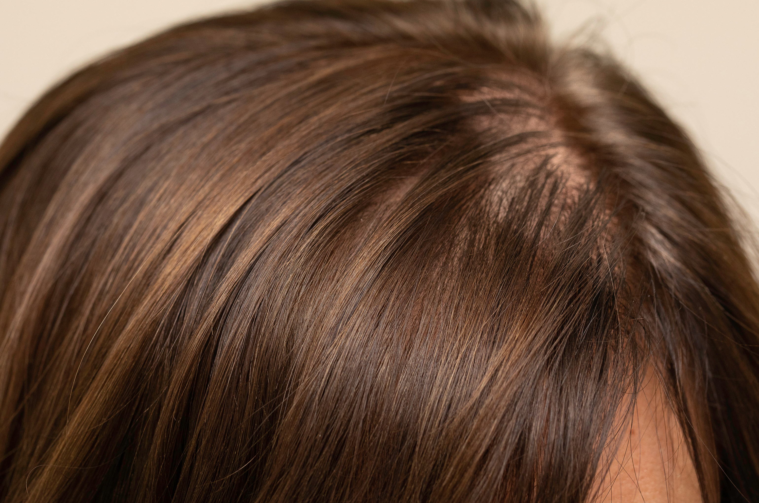 The Science Behind DHT Blocker Results for Hair Fall  Clinikally