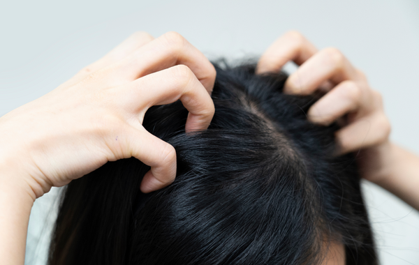 Scratching Scalp with Dandruff