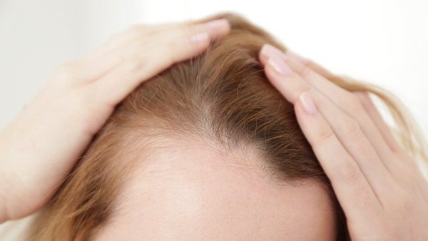Woman looking at her thinning hairline