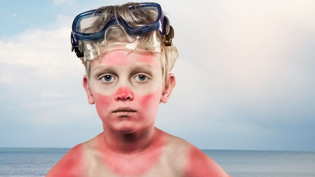 Not applying enough spray sunscreen can lead to sunburn