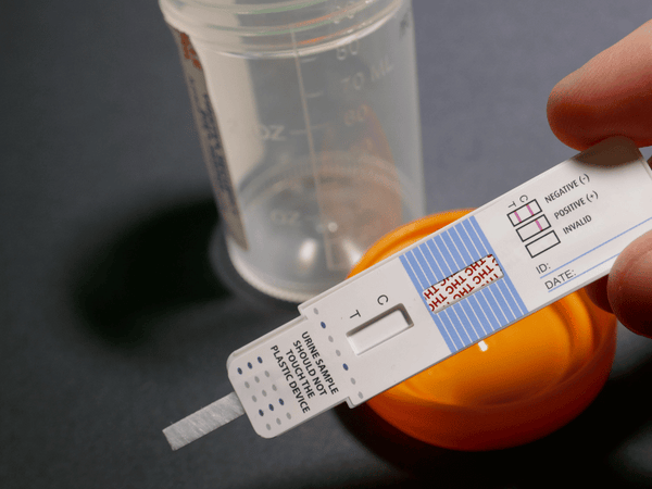 An image of urine test