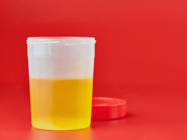 Urine test