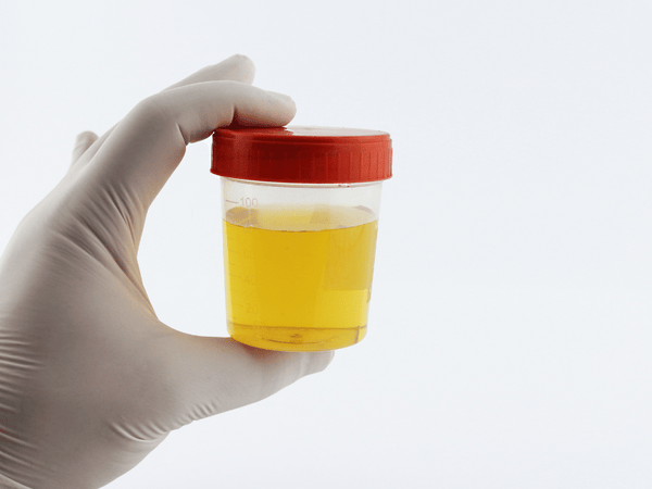 urine test