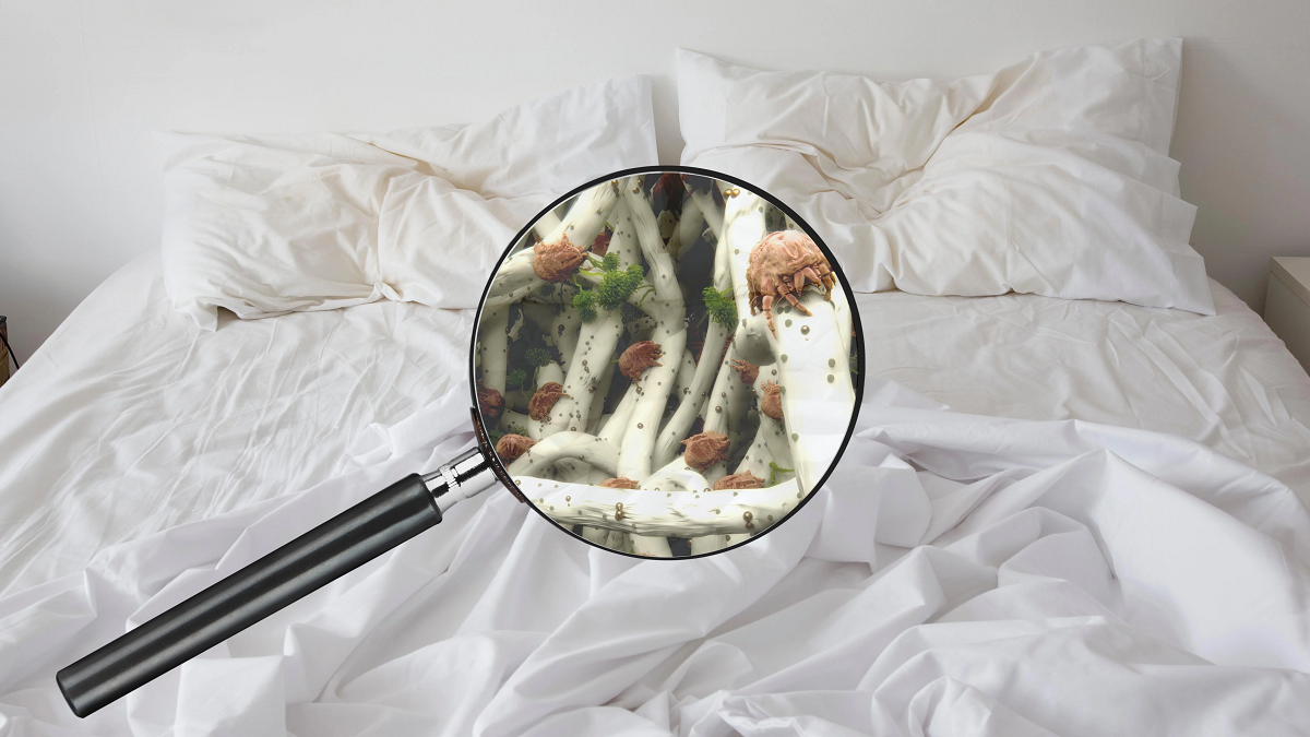 Bacteria caused acne from dirty bedding - dust-mites and waste