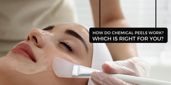 types of chemical peels and its benefits