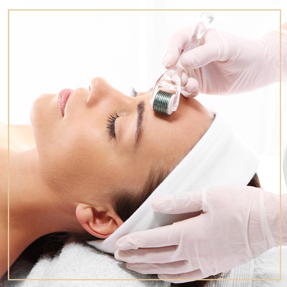 microneedling treatment for face acne and scar