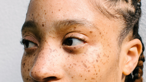 black model with freckles