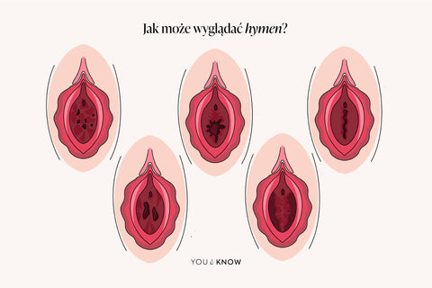 ilustracja rodzaje hymen