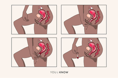 Ilustracja wyjmowania tamponu