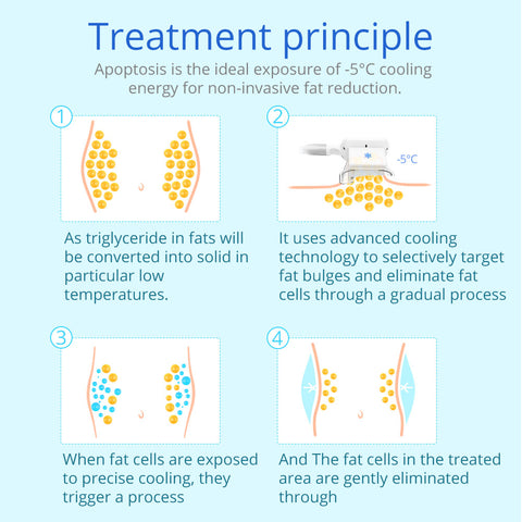 freezing fat treatment