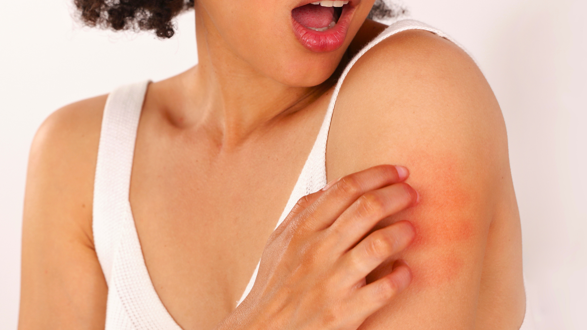 woman with itchy shoulder