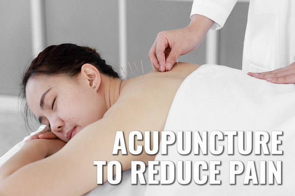 Woman getting acupuncture on her back to help her relieve the pain she is feeling. On the bottom right it says "acupuncture to reduce pain".