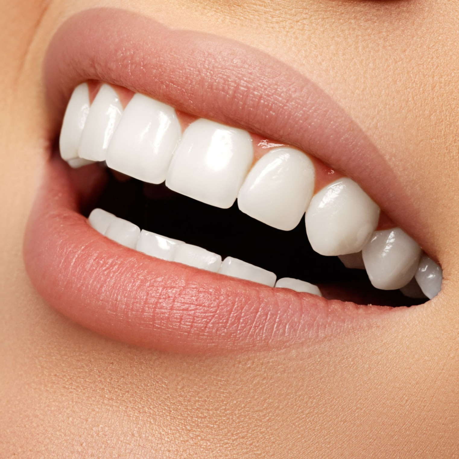 Stylo-blanchiment-des-dents-luxe-blanc