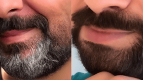 GreyAway Beard Before & After