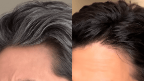 GreyAway Hair Before & After