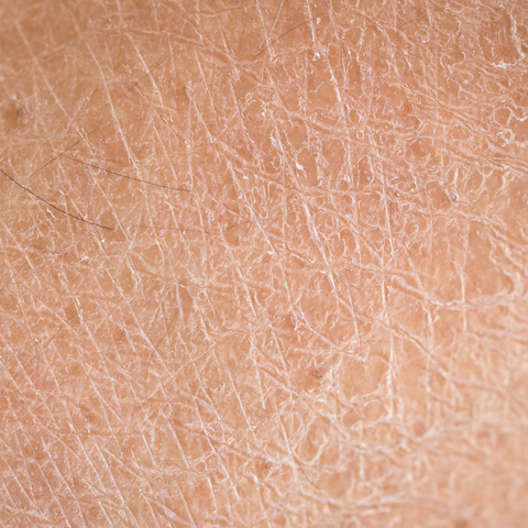 What Causes Sensitive Skin and How Can You Care for It? 