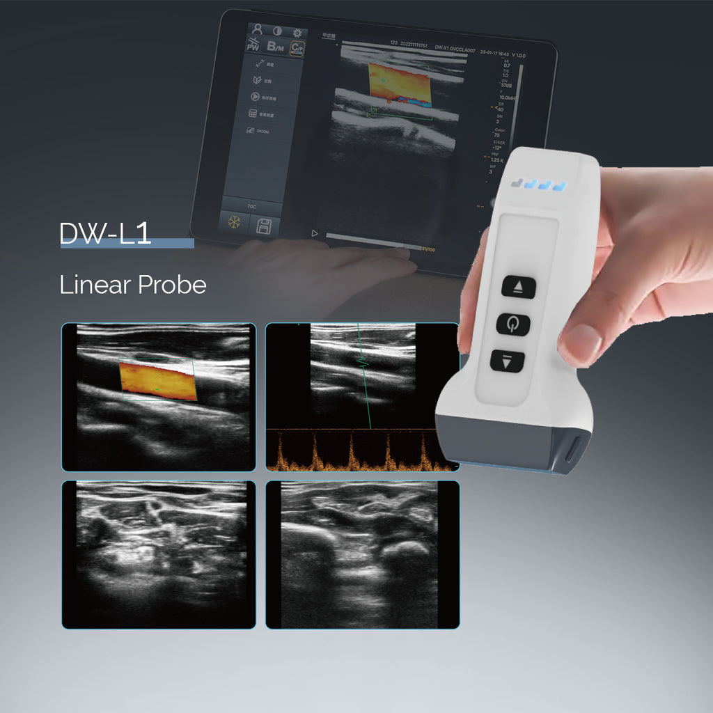 wireless ultrasound Linear Probe DW-L1