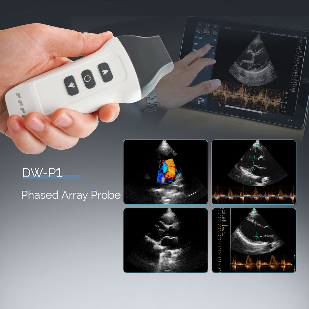 wireless ultrasound Phrased Probe DW-P1