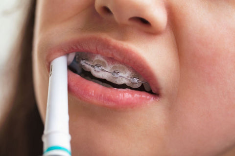 ¿Son mejores los cepillos de dientes eléctricos?