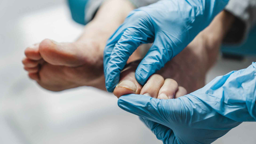 A doctor wearing blue gloves examining a foot.