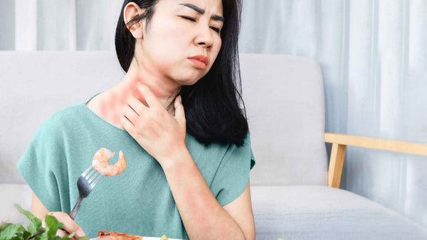 A woman experiences anaphylaxis after eating a plate of shrimp.