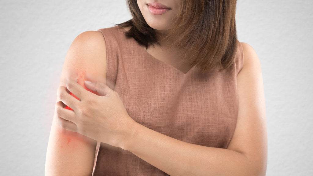 Woman scratching her arm due to an itch or skin irritation.