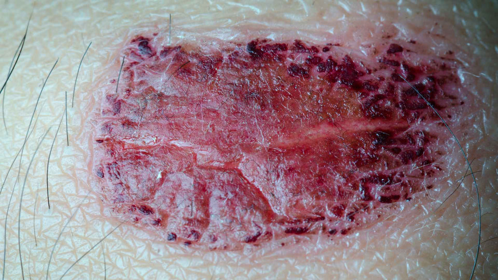 Closeup of a scab