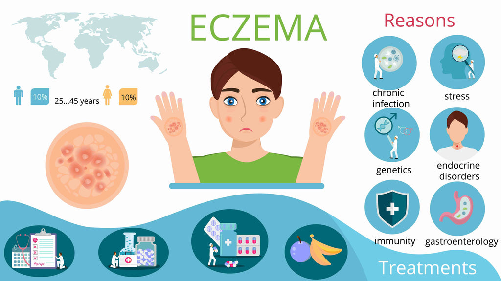 Eczema Infographic