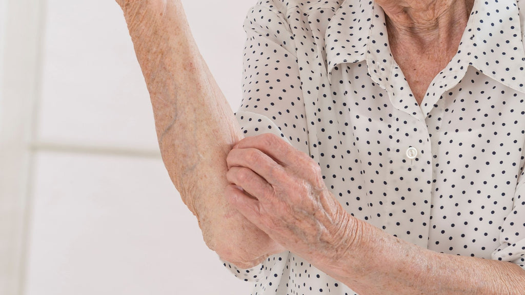 Elderly woman itching skin
