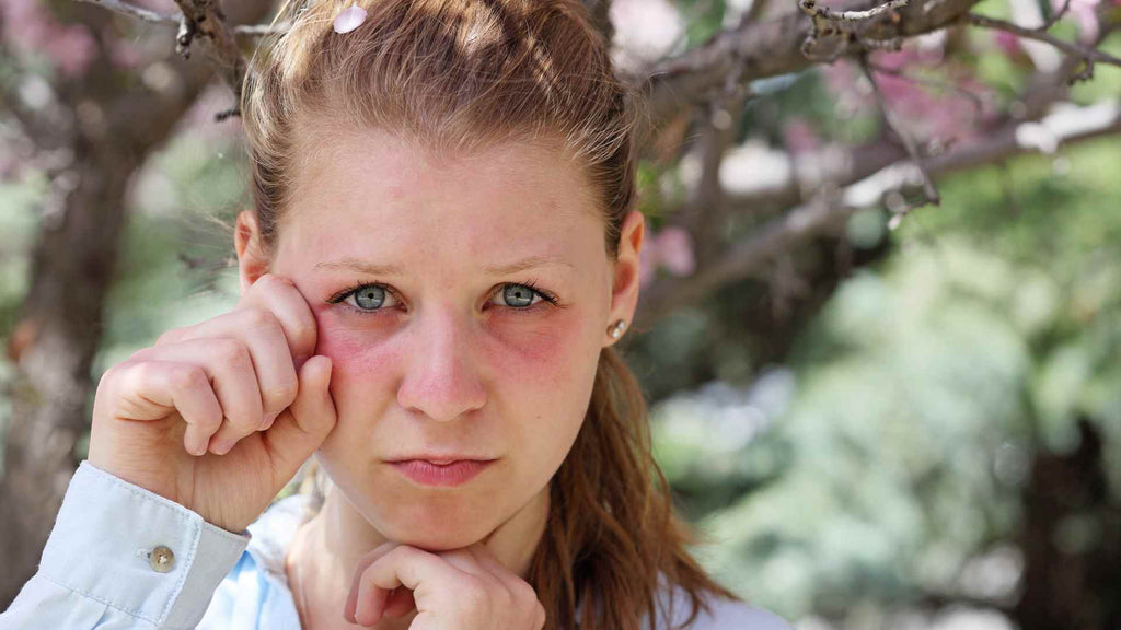 A woman enduring allergies and eyelid pruritus while standing in front of a tree.