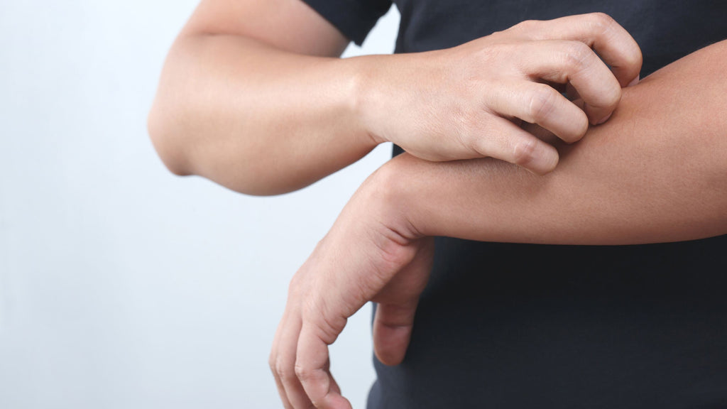 A man is experiencing fiberglass rash irritation on his arm.