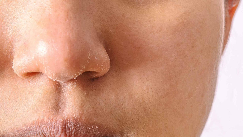 Dry skin can make your face itchy