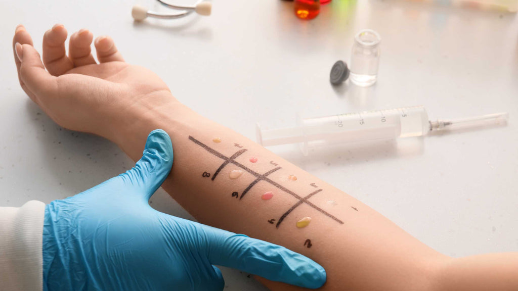 Allergy skin testing procedure on a person's forearm with marked reactions to allergens.
