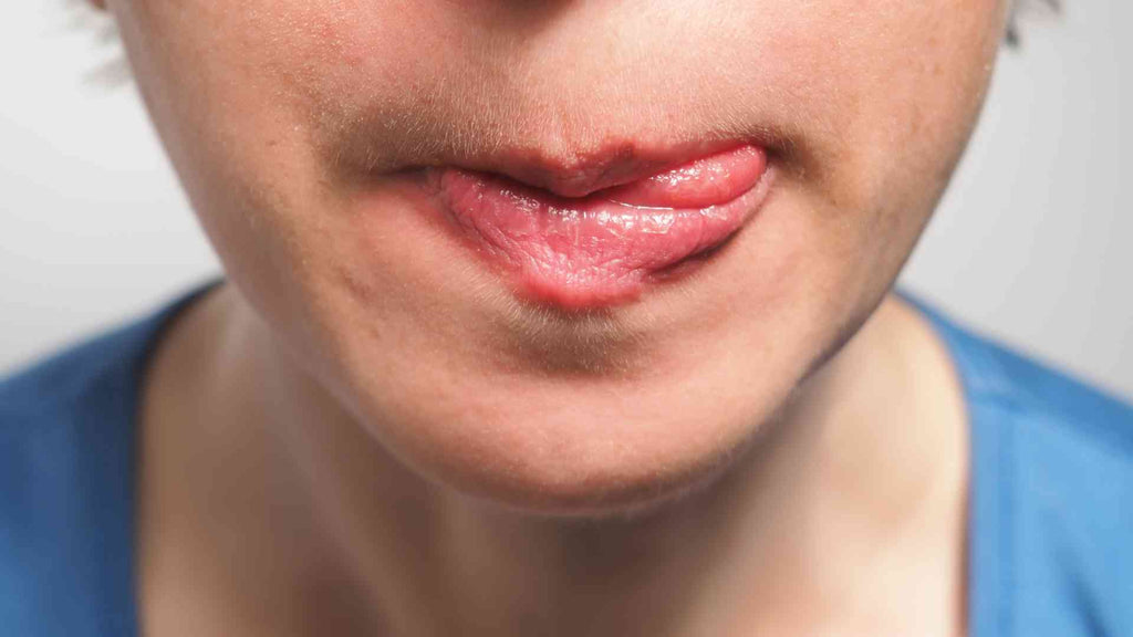 Woman licking dry eczema lips