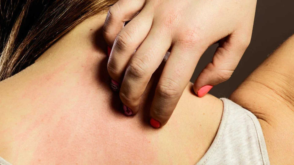 A woman with neuropathic itch scratches without relief.