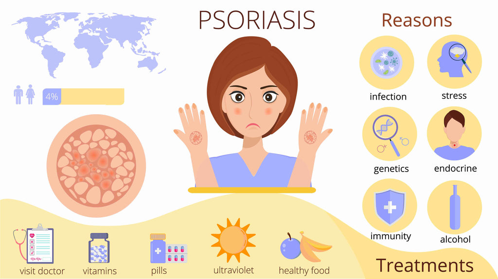 Psoriasis infographic