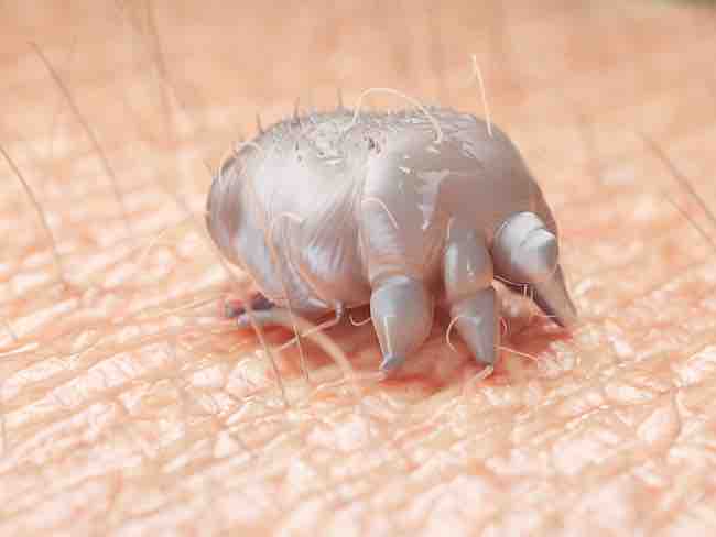 Scabies can causes itchy skin