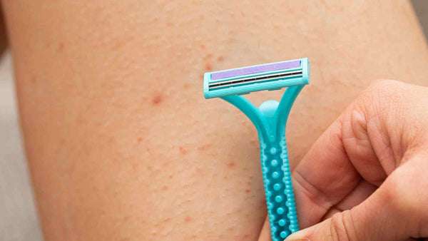 A person experiencing itchy bumps on their legs after shaving.