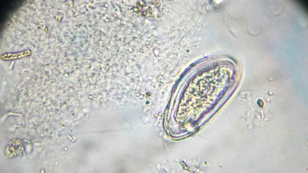 A pinworm egg