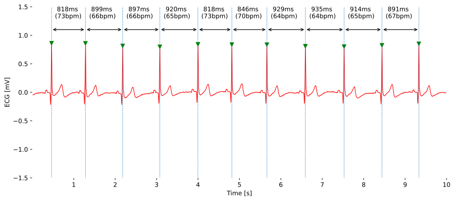 Capturing Biosignals Timing and Durations