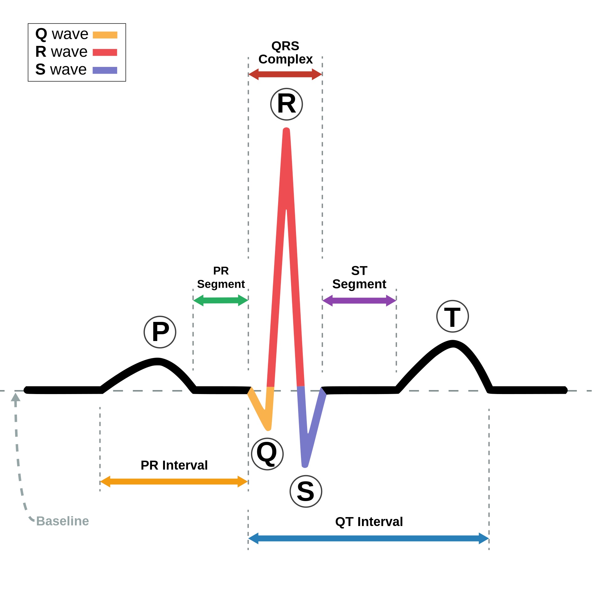 Examples of ECG characteristics and features