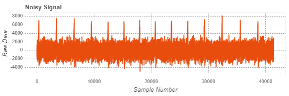 Noisy signal biosignals