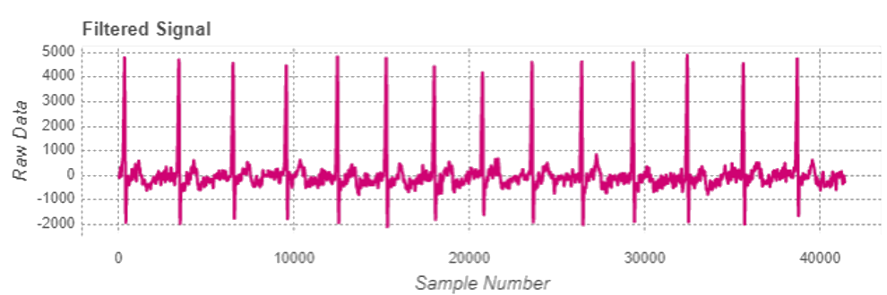 Filtered signal