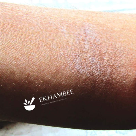 very dry skin on arm with eczema patch